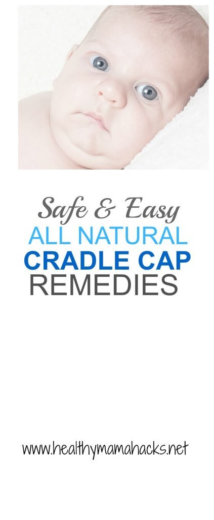 Clear up your baby's cradle cap safely and easily with these great natural home remedies! 