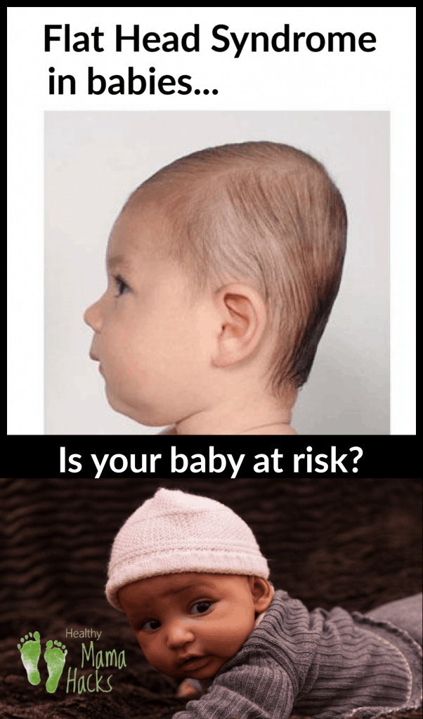 Find out if your newborn is at risk for plagiocephaly and learn some great tips for how to prevent flat spots on your baby's head. How to avoid and even reverse flat head syndrome in your infant! #plagiocephaly, #flatheadsyndrome, #flatheadinbabies, #flathead