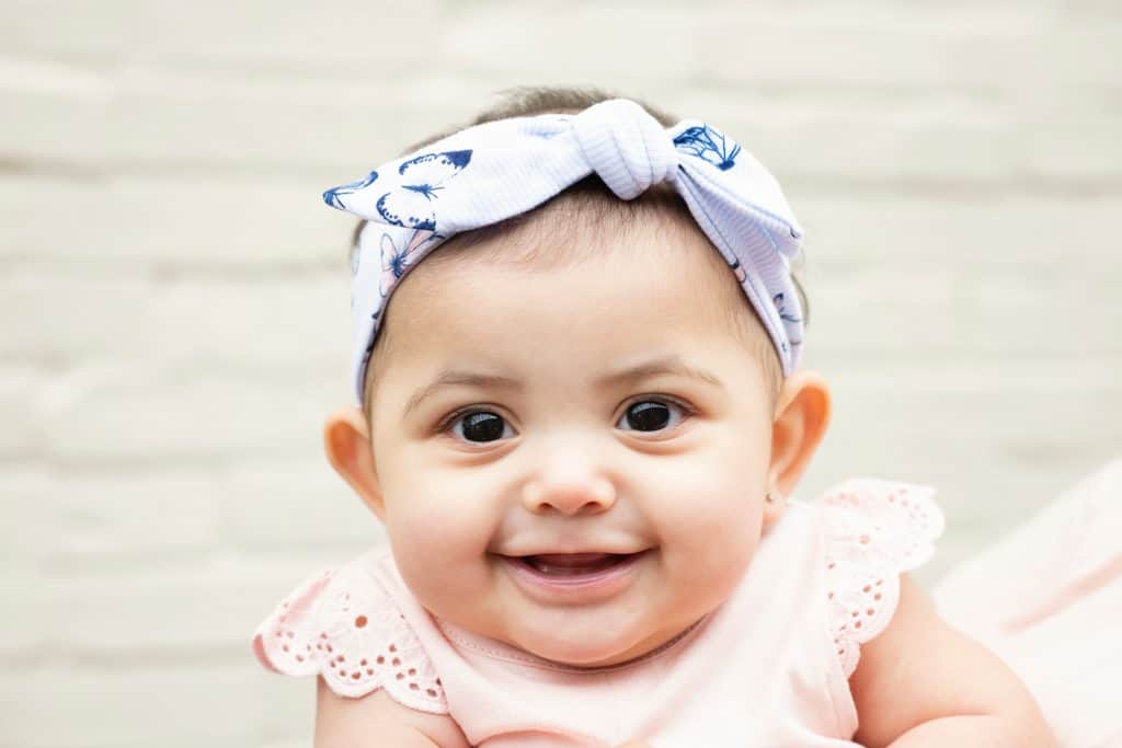 positional plagiocephaly